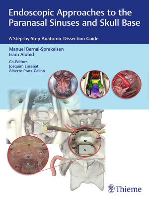 cover image of Endoscopic Approaches to the Paranasal Sinuses and Skull Base